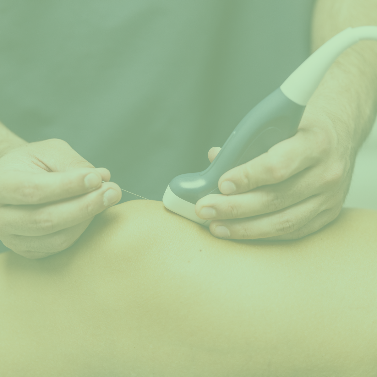 Médico realizando una punción ecoguiada con filtro verde claro